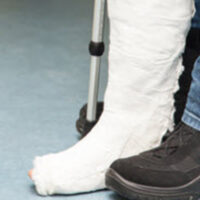 InjuredLeg InjuredLeg