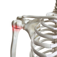 Injury7 Injury7