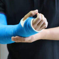 InjuredArm InjuredArm