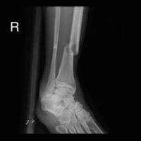 X-Ray2 X-Ray2