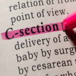 C_Section