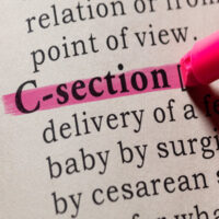 C_Section