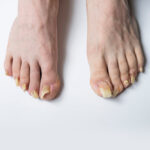 FootCare